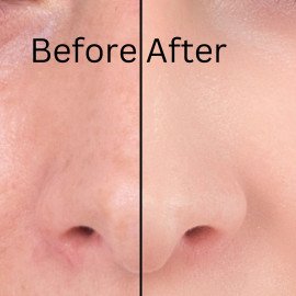 Beauty Track White Nose Pore Strips